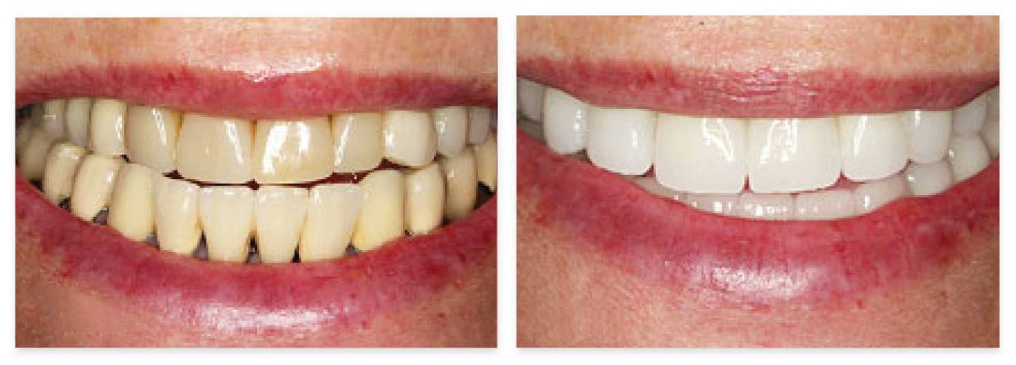 Dentist Stratford, CT Brush & Floss Dental Center Stratford, CT