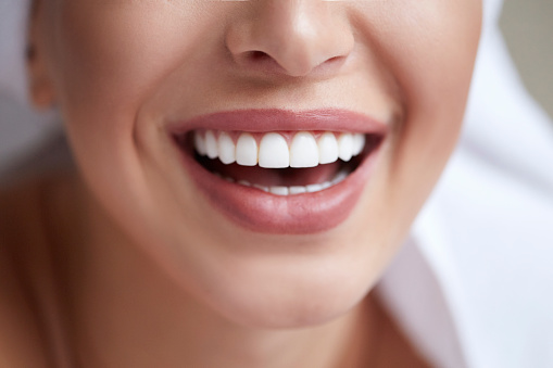 Image of a woman smile close up near Brush & Floss Dental Center.