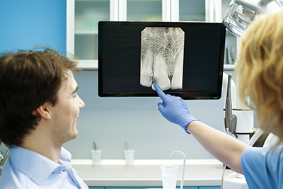 All You Need to Know About Dental X-Rays