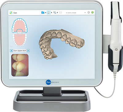 itero scanner diagram provided by Brush & Floss Dental Center in Stratford, CT 