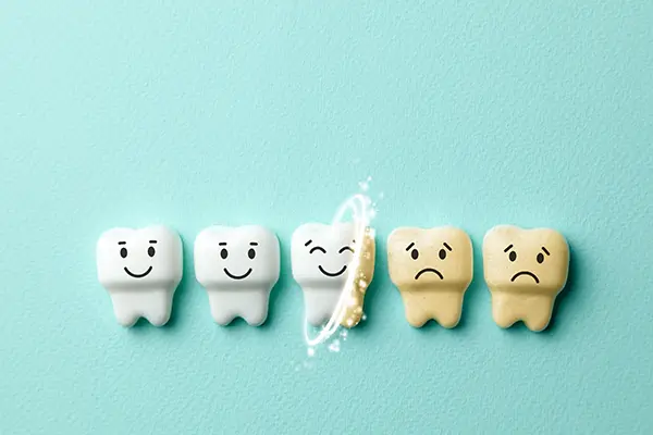 A row of toy teeth passing through teeth whitening that changes them from sad and yellowed to white and happy.